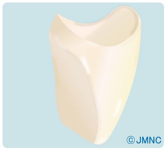 オールセラミッククラウン