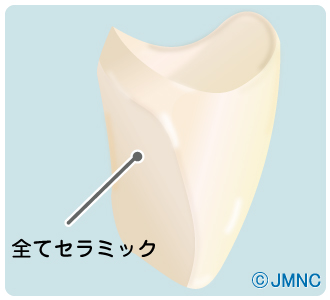 オールセラミッククラウン