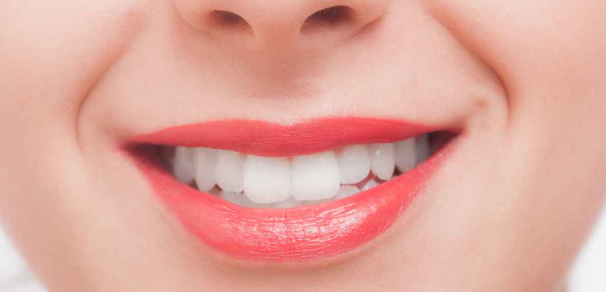 自由診療で実現する美しい歯並び