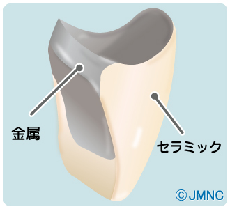 ポーセレンクラウン