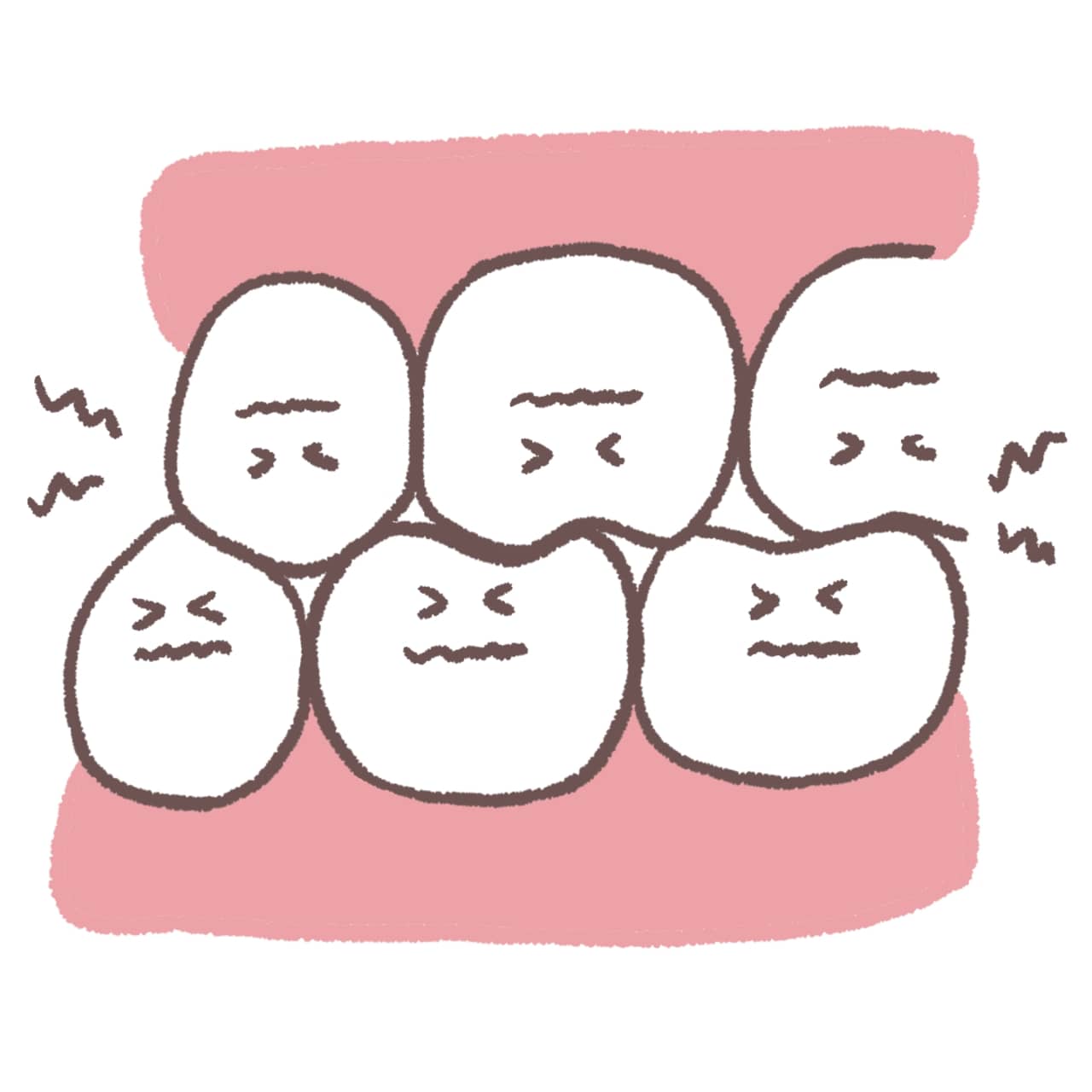 歯ぎしり・くいしばりのイラスト