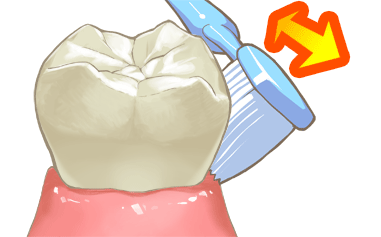 歯周病ケアのブラッシング角度